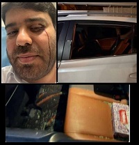 تیراندازی به مدیر مجتمع پتروشیمی امیرکبیر در ماهشهر + تصاویر تیراندازی به مدیر مجتمع پتروشیمی امیرکبیر در ماهشهر + تصاویر